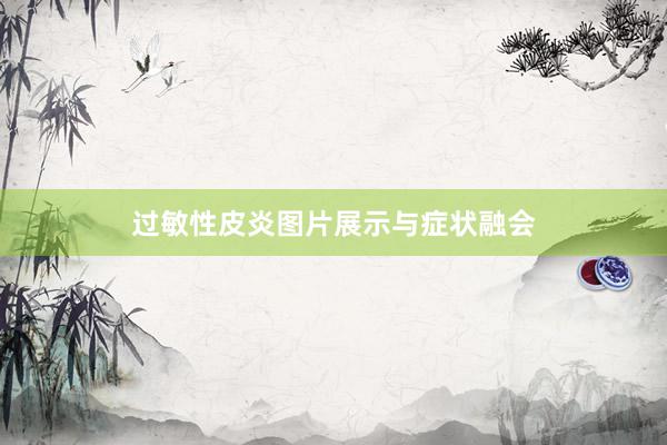 过敏性皮炎图片展示与症状融会